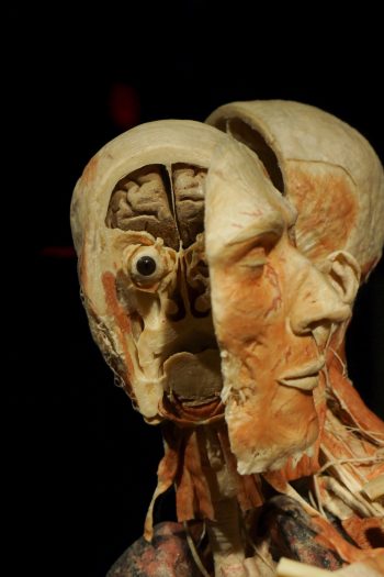 <b>Author:</b> Matty Stevenson<br>
<b>License:</b> <a href="https://creativecommons.org/licenses/by-nc-sa/2.0/" target="_blank" rel="noopener">CC BY-NC-SA 2.0</a> Body Worlds Vital3 Flickr Matty Stevenson CC BY NC SA 2 0